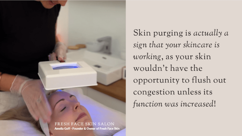 What to Expect When Using New Skincare Products - Fresh Face Skin