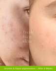 Pro Ageing Pack - Fresh Face Skin
