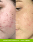 Healer Cleanser - Fresh Face Skin