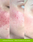 Skin Barrier Repair Pack