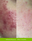 Skin Barrier Repair Pack