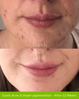 Healer Cleanser - Fresh Face Skin
