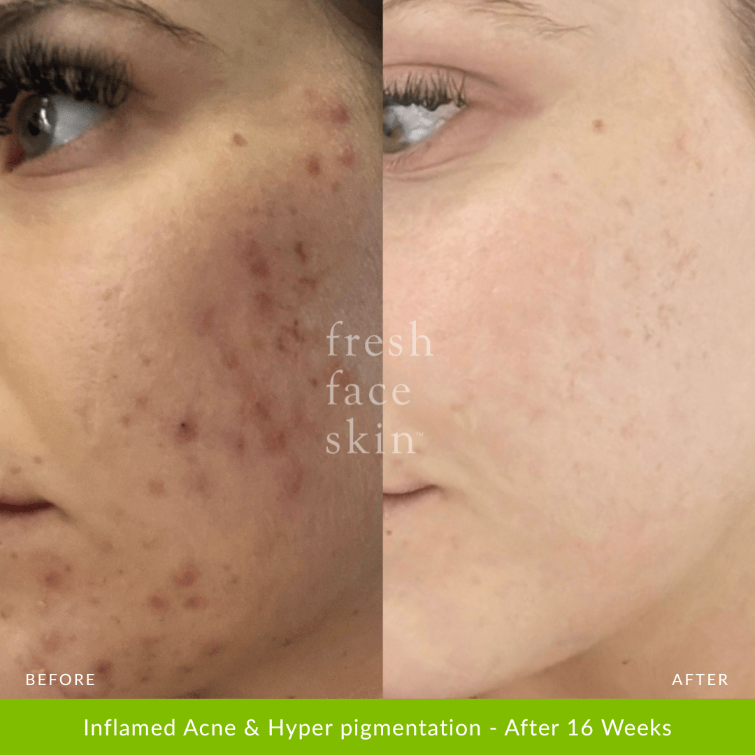 Hydrate Me Starter Pack - Fresh Face Skin