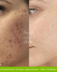 Hydrate Me Starter Pack - Fresh Face Skin