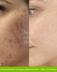 Healer Cleanser - Fresh Face Skin