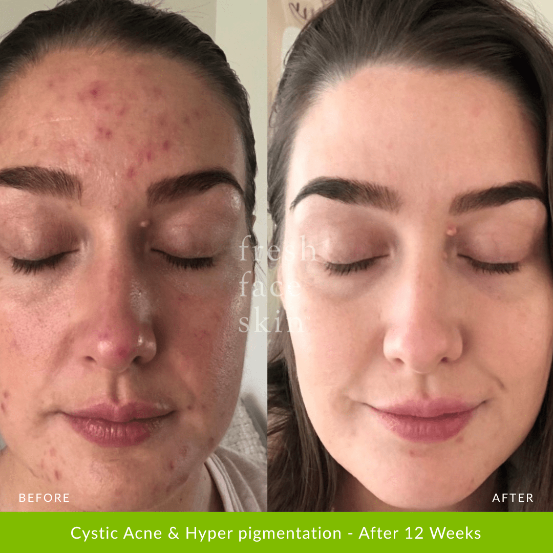 Hydrate Me Starter Pack - Fresh Face Skin