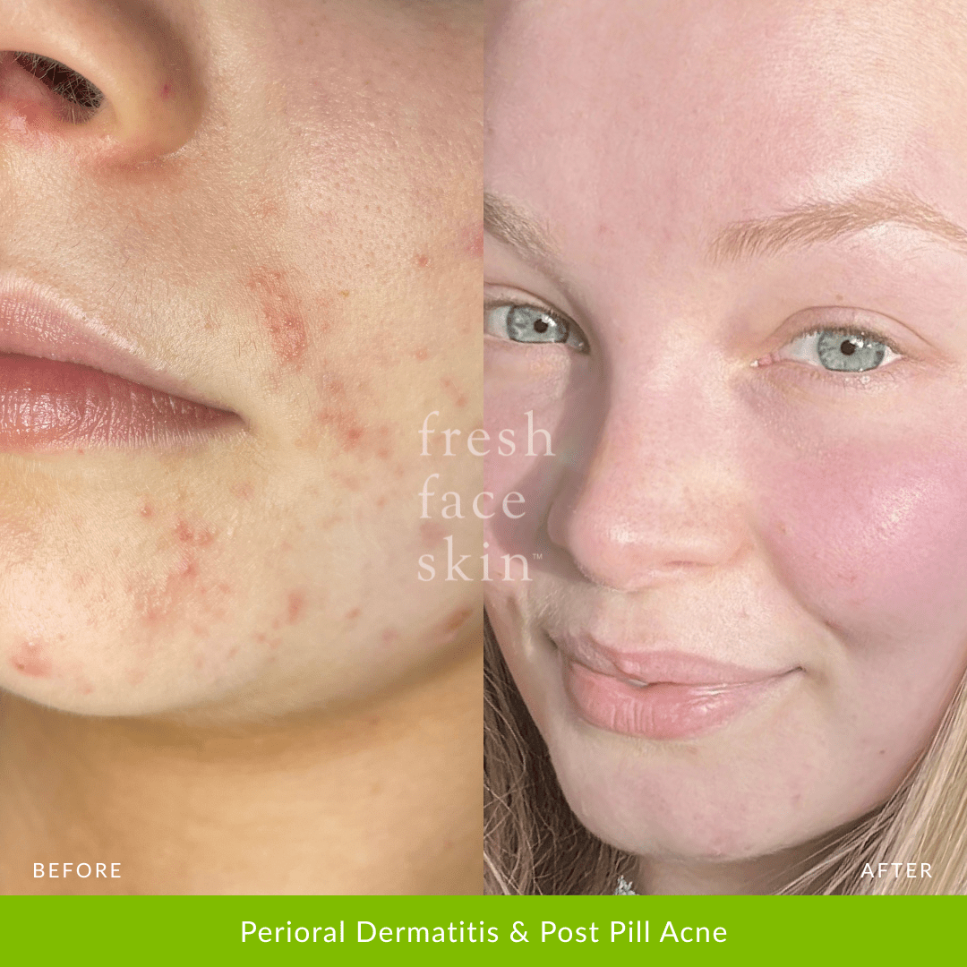 Hydration Duo - Fresh Face Skin