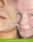 Hydration Duo - Fresh Face Skin