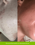 Hydration Duo - Fresh Face Skin