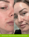 Hydration Duo - Fresh Face Skin