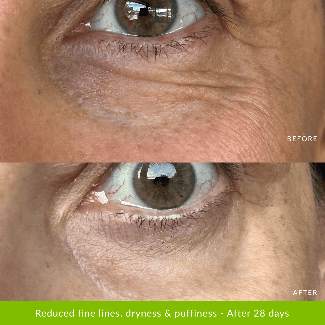 Pro Ageing Pack - Fresh Face Skin