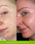 Barrier Mist - Fresh Face Skin