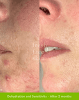 Pro Ageing Pack - Fresh Face Skin