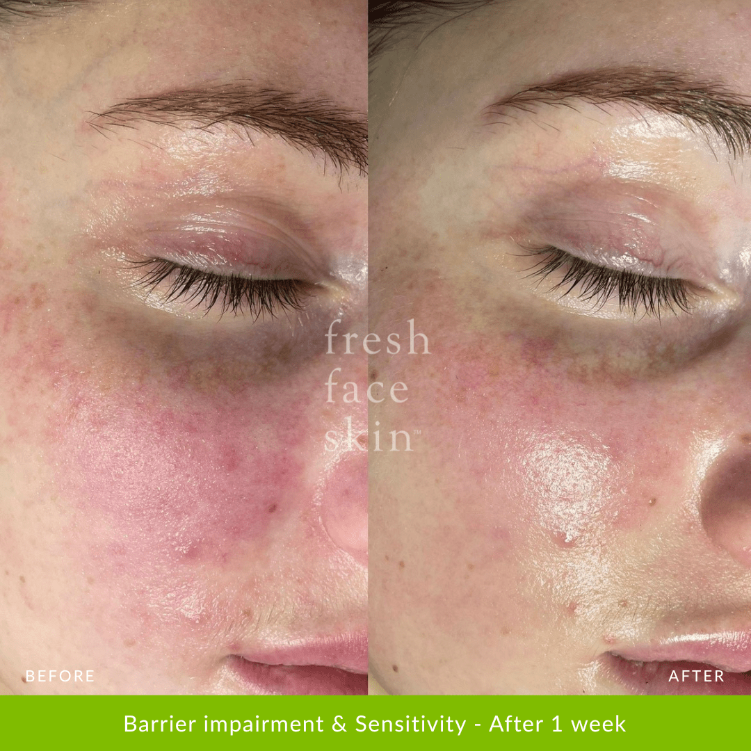 Recovery Mask - Fresh Face Skin