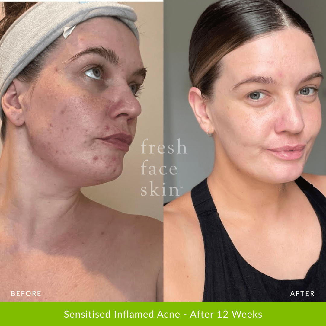 Hydrate Me Starter Pack - Fresh Face Skin