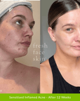 Hydrate Me Starter Pack - Fresh Face Skin