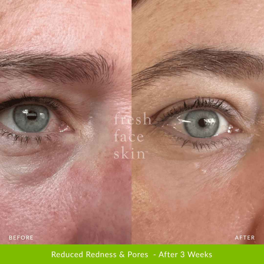 Skin Barrier Repair Pack - Fresh Face Skin