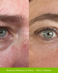Skin Barrier Repair Pack