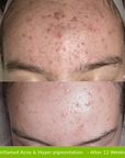 Healer Cleanser - Fresh Face Skin
