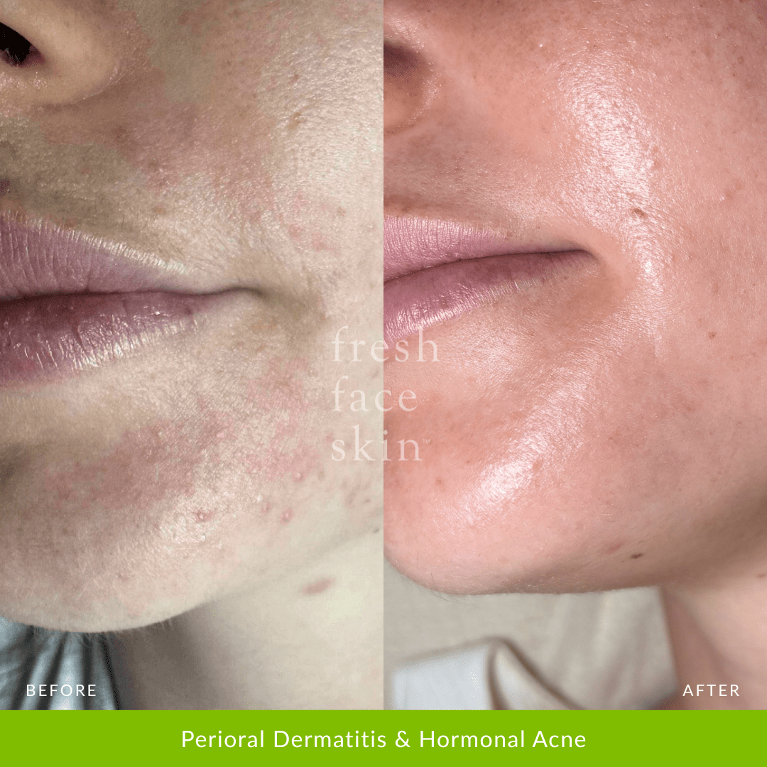 Hydration Duo - Fresh Face Skin