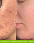 Healer Cleanser - Fresh Face Skin