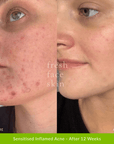 Hydrate Me Starter Pack - Fresh Face Skin