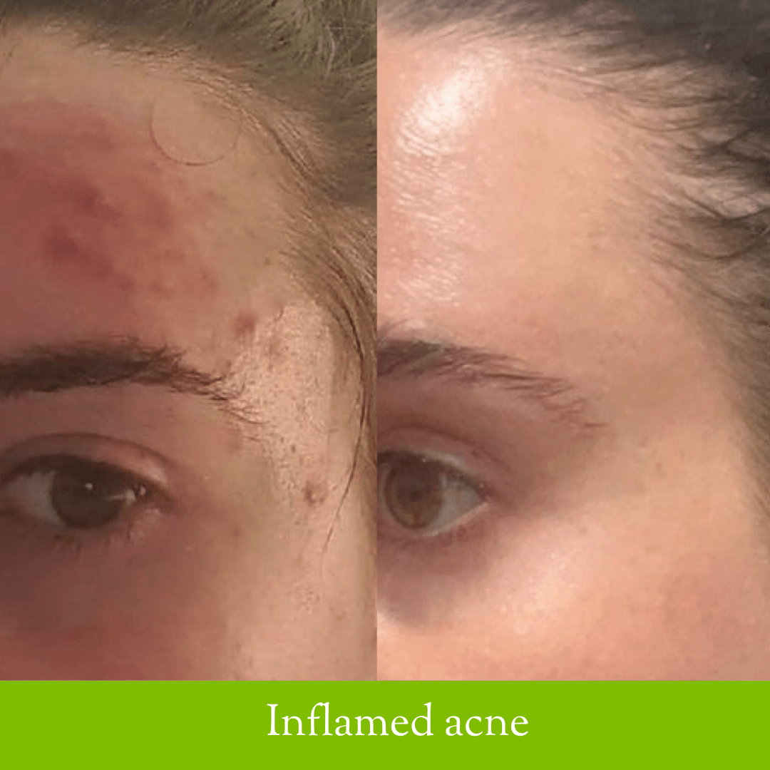 Soother Cleanser - Fresh Face Skin