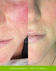 Skin Barrier Repair Pack