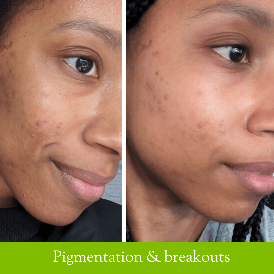 Soother Cleanser - Fresh Face Skin