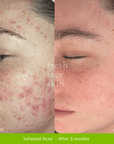 Hydrate Me Starter Pack - Fresh Face Skin
