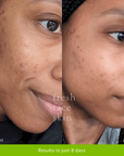 Skin Brightening Pack - Fresh Face Skin
