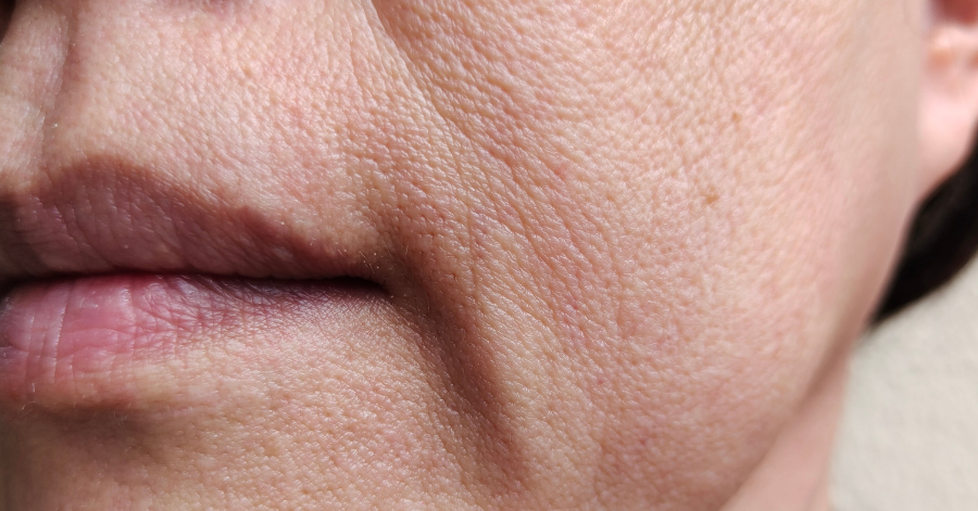 Fine lines mature skin