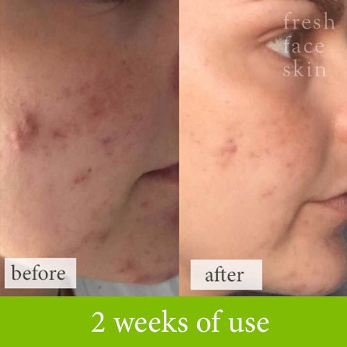 Reverser Cleanser - Fresh Face Skin