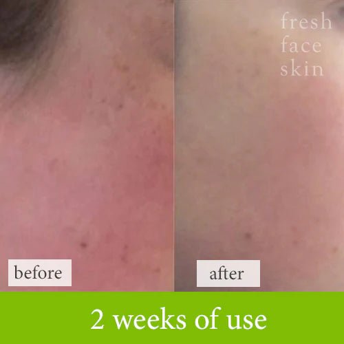 Soothe & Sculpt Pack - Fresh Face Skin
