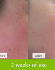 Soothe & Sculpt Pack - Fresh Face Skin