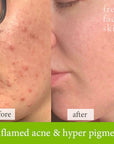 Soothe & Sculpt Pack - Fresh Face Skin