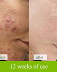 Soothe & Sculpt Pack - Fresh Face Skin