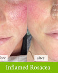Soothe & Sculpt Pack - Fresh Face Skin