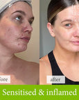 Soothe & Sculpt Pack - Fresh Face Skin