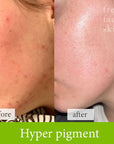Hydrate & Renew Pack - Fresh Face Skin