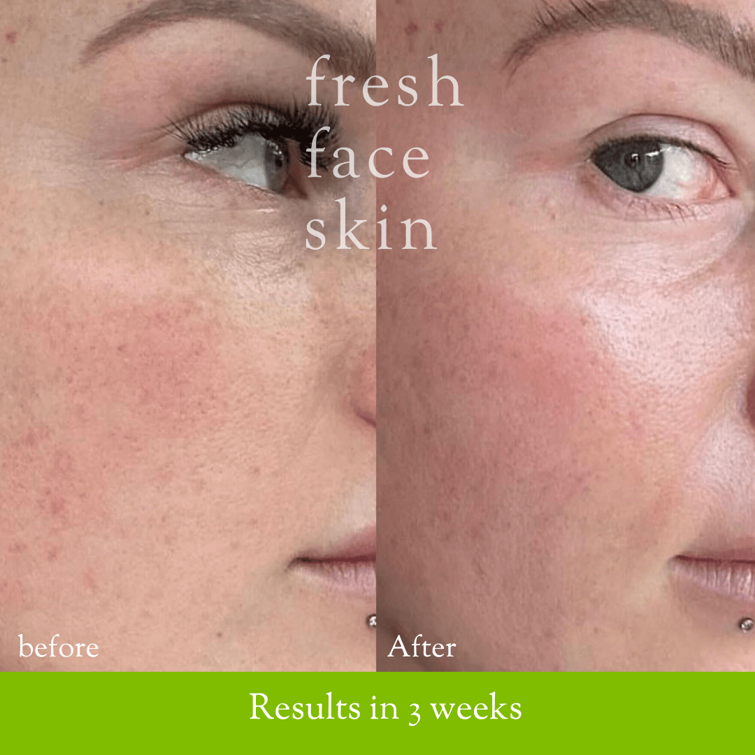 L - Ascorbic Acid Vitamin C Powder - Fresh Face Skin