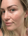 Skin Barrier Repair Pack - Fresh Face Skin