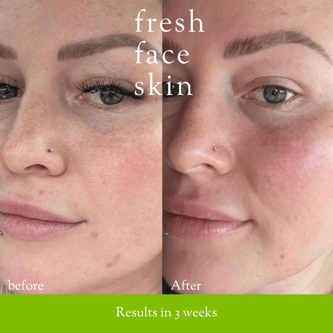 Hydrate & Renew Pack - Fresh Face Skin