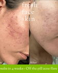 Hydrate & Renew Pack - Fresh Face Skin