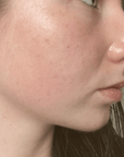 Skin Barrier Repair Pack - Fresh Face Skin