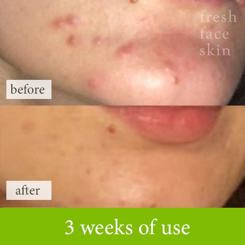 Healer Cleanser - Fresh Face Skin