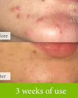 Healer Cleanser - Fresh Face Skin