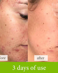 Healer Cleanser - Fresh Face Skin