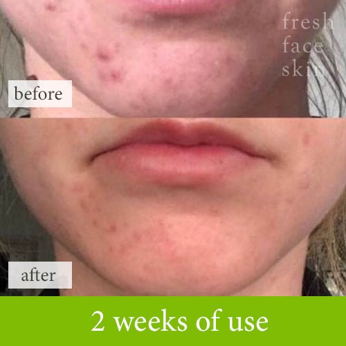 Healer Cleanser - Fresh Face Skin