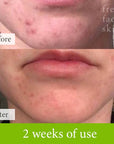 Healer Cleanser - Fresh Face Skin